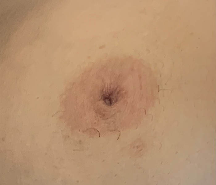 Nipple-pre