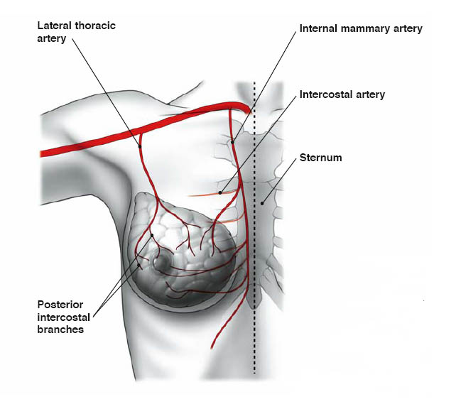 autologous reconstruction 3