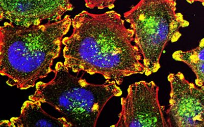 Ludwig Cancer Research study reveals even transient chromosomal errors can initiate cancer