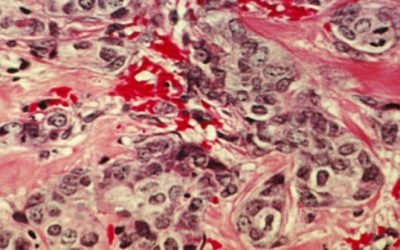 Breast cancer stem cells may use an arteriolar niche to prepare for metastasis