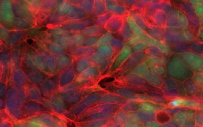 $8M from Snow Medical Research Foundation to improve outcomes for breast cancer patients